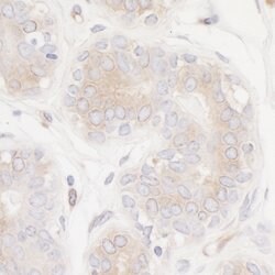 PTPN12 Recombinant Rabbit Monoclonal Antibody (BL-5-2F8), Bethyl Laboratories