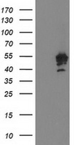 PTPN7 Monoclonal Antibody (OTI3B10), TrueMAB , OriGene 30 &mu;L; Unconjugated:Antibodies,
