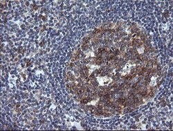 PTPRC Mouse anti-Human, Clone: OTI2H1, lyophilized, TrueMAB 100 &mu;g;