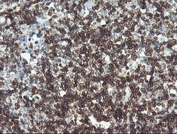 PTPRC Mouse anti-Human, Clone: OTI2F1, lyophilized, TrueMAB 100 &mu;g;