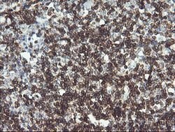 PTPRC Monoclonal Antibody (OTI2F1), TrueMAB , OriGene 100 &mu;L; Unconjugated:Antibodies,