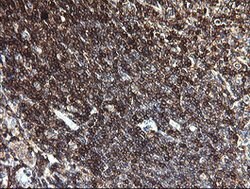 PTPRC Mouse anti-Human, Clone: OTI3D8, lyophilized, TrueMAB 100 &mu;g;