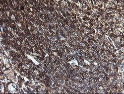 PTPRC Monoclonal Antibody (OTI3D8), TrueMAB , OriGene 100 &mu;L; Unconjugated:Antibodies,