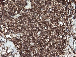 PTPRC Mouse anti-Human, Clone: OTI3D8, lyophilized, TrueMAB 100 &mu;g;