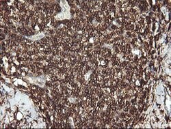 PTPRC Monoclonal Antibody (OTI3D8), TrueMAB , OriGene 100 &mu;L; Unconjugated:Antibodies,
