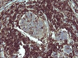 PTPRC Monoclonal Antibody (OTI1F6), TrueMAB , OriGene:Antibodies:Primary