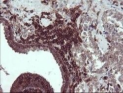 PTPRC Monoclonal Antibody (OTI1F6), TrueMAB , OriGene:Antibodies:Primary