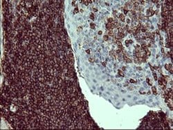 PTPRC Monoclonal Antibody (OTI3D1), TrueMAB , OriGene:Antibodies:Primary