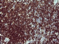 PTPRC Monoclonal Antibody (OTI3D1), TrueMAB , OriGene:Antibodies:Primary