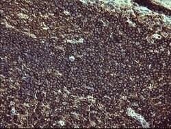 PTPRC Mouse anti-Human, Clone: OTI4C11, lyophilized, TrueMAB 100 &mu;g;