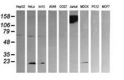 PTPRC Mouse anti-Human, Clone: OTI1B7, TrueMAB , Origene 30 &mu;L; Unconjugated:Antibodies,