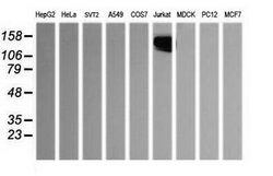 PTPRC Mouse anti-Human, Clone: OTI2H1, lyophilized, TrueMAB 100 &mu;g;