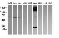 PTPRC Mouse anti-Human, Clone: OTI2F1, lyophilized, TrueMAB 100 &mu;g;
