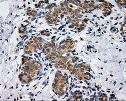 PTPRE Monoclonal Antibody (OTI5E8), TrueMAB , OriGene 100 &mu;L; Unconjugated:Antibodies,