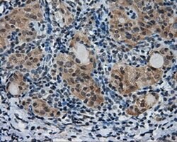 PTPRE Monoclonal Antibody (OTI5E8), TrueMAB , OriGene 100 &mu;L; Unconjugated:Antibodies,