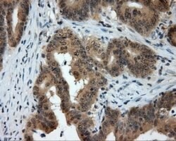 PTPRE Monoclonal Antibody (OTI5E8), TrueMAB , OriGene 100 &mu;L; Unconjugated:Antibodies,