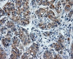 PTPRE Monoclonal Antibody (OTI5E8), TrueMAB , OriGene 100 &mu;L; Unconjugated:Antibodies,