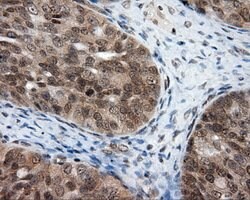 PTPRE Mouse anti-Human, Clone: OTI3H8, lyophilized, TrueMAB 100 &mu;g;