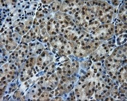 PTPRE Mouse anti-Human, Clone: OTI3H8, lyophilized, TrueMAB 100 &mu;g;