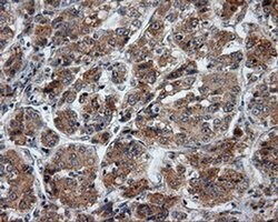 PTPRE Monoclonal Antibody (OTI3H8), TrueMAB , OriGene 30 &mu;L; Unconjugated:Antibodies,