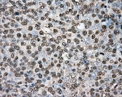 PTPRE Mouse anti-Human, Clone: OTI3D4, lyophilized, TrueMAB 100 &mu;g;