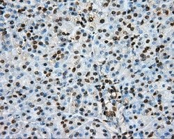 PTPRE Mouse anti-Human, Clone: OTI3D4, lyophilized, TrueMAB 100 &mu;g;