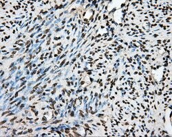 PTPRE Mouse anti-Human, Clone: OTI3D4, lyophilized, TrueMAB 100 &mu;g;