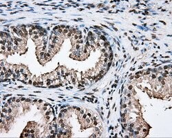 PTPRE Mouse anti-Human, Clone: OTI3D4, lyophilized, TrueMAB 100 &mu;g;