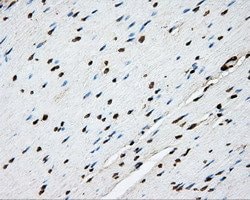 PTPRE Mouse anti-Human, Clone: OTI3D4, lyophilized, TrueMAB 100 &mu;g;