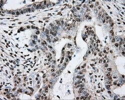 PTPRE Mouse anti-Human, Clone: OTI3D4, lyophilized, TrueMAB 100 &mu;g;