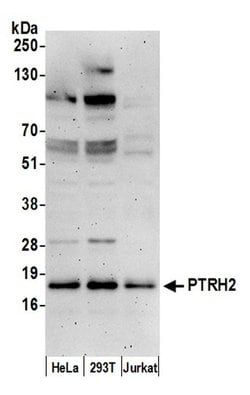 PTRH2/BIT1 Polyclonal Antibody, Bethyl Laboratories 20 &mu;L | Buy Online | Bethyl Laboratories, Inc | Fisher Scientific