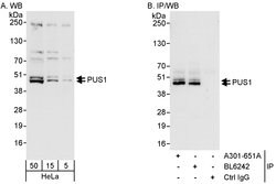 PUS1 Rabbit anti-Human, Polyclonal, Bethyl Laboratories 100 &mu;L; Unconjugated:Antibodies,