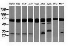 PUS7 Mouse anti-Canine, Human, Rat, Clone: OTI5F12, lyophilized, TrueMAB