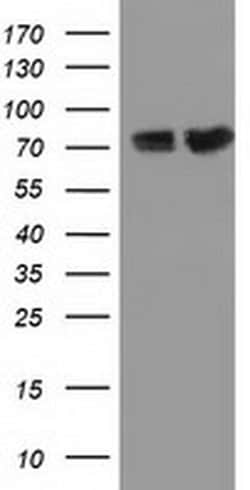 PUS7 Mouse anti-Canine, Human, Rat, Clone: OTI4C6, liquid, TrueMAB 100