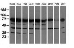 PUS7 Mouse anti-Canine, Human, Rat, Clone: OTI4C6, liquid, TrueMAB 100