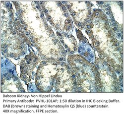Von Hippel Lindau Rabbit anti-Human, Mouse, Non-human Primate, Rat, Polyclonal,