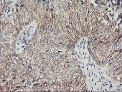 PVRL1 Monoclonal Antibody (OTI6F8), TrueMAB , OriGene 100 &mu;L; Unconjugated:Antibodies,