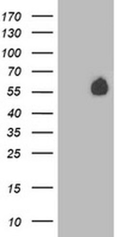 PVRL1 Monoclonal Antibody (OTI6E11), TrueMAB , OriGene 100 &mu;L; Unconjugated:Antibodies,