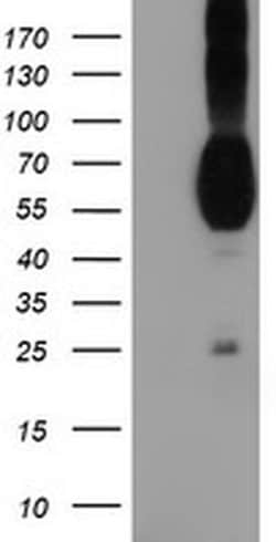 PVRL1 Monoclonal Antibody (OTI6F8), TrueMAB , OriGene 100 &mu;L; Unconjugated:Antibodies,