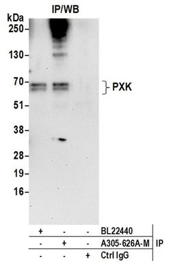 PXK Polyclonal Antibody, Bethyl Laboratories 20 &mu;L | Buy Online | Bethyl Laboratories, Inc | Fisher Scientific