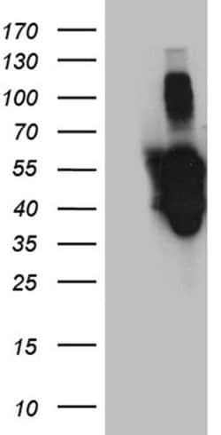 PXN Monoclonal Antibody (OTI1H10), TrueMAB , OriGene:Antibodies:Primary