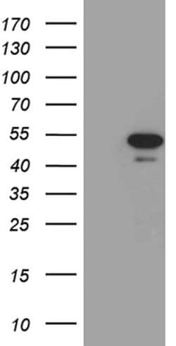 PXN Mouse anti-Human, Clone: OTI2B8, lyophilized, TrueMAB 100 &mu;g; Unconjugated:Antibodies,