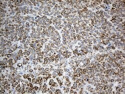 PYCR1 Mouse anti-Human, Clone: OTI4F2, lyophilized, TrueMAB 100 &mu;g;