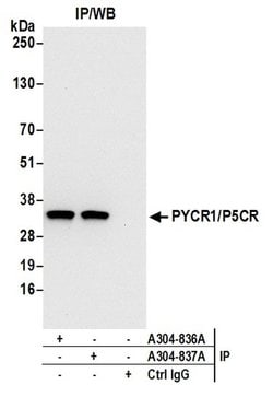 PYCR1/P5CR Rabbit anti-Human, Polyclonal, Bethyl Laboratories 100 &mu;L;