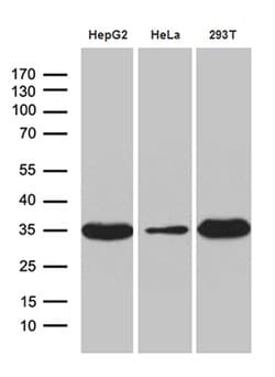 PYCR1 Mouse anti-Human, Clone: OTI4F2, lyophilized, TrueMAB 100 &mu;g;