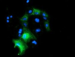 PYCR2 Mouse anti-Human, Clone: OTI5C7, lyophilized, TrueMAB 100 &mu;g;