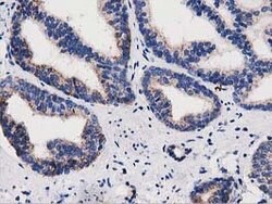PYCR2 Mouse anti-Human, Clone: OTI5C7, lyophilized, TrueMAB 100 &mu;g;