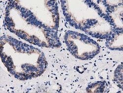PYCR2 Monoclonal Antibody (OTI5C7), TrueMAB , OriGene 30 &mu;L; Unconjugated:Antibodies,