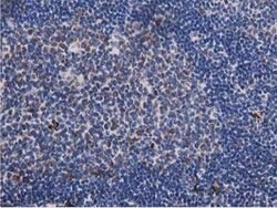 PYCR2 Mouse anti-Human, Clone: OTI5C7, lyophilized, TrueMAB 100 &mu;g;