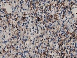 PYCR2 Mouse anti-Human, Clone: OTI5C7, lyophilized, TrueMAB 100 &mu;g;